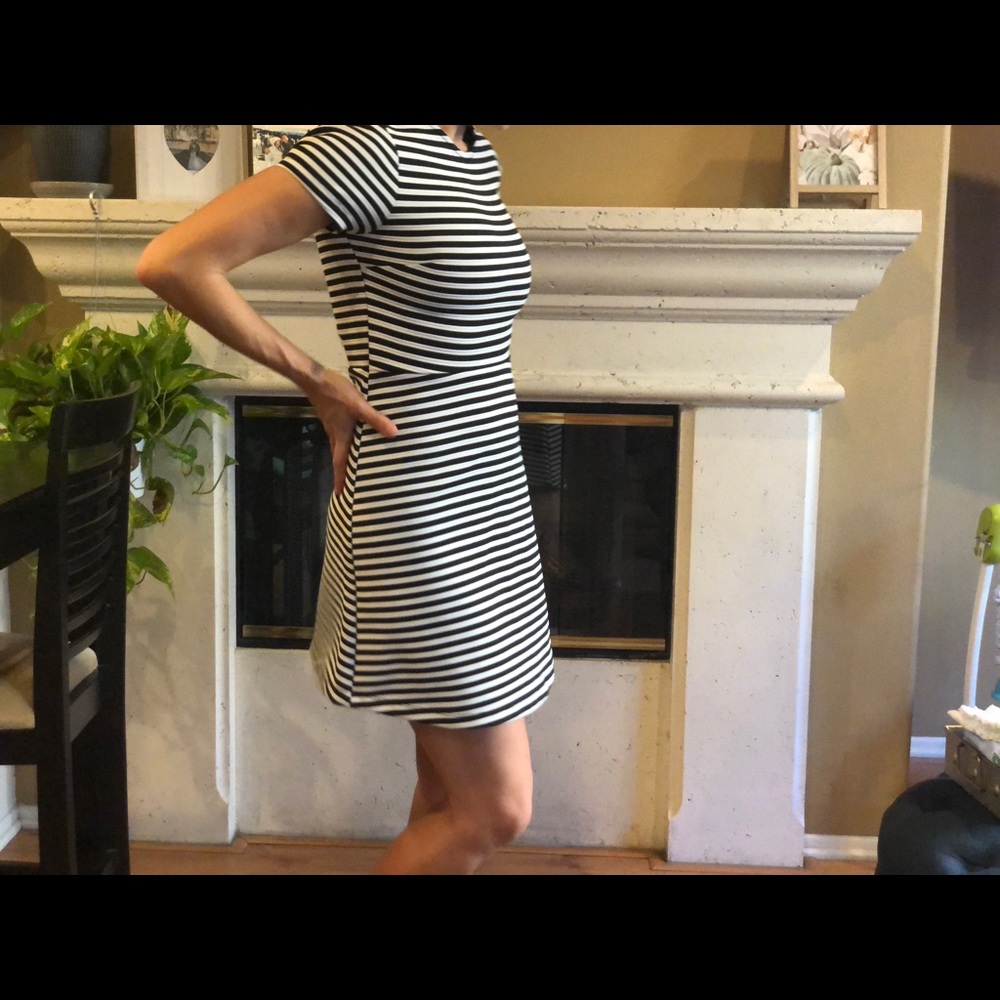 Topshop Black and White Striped Mini Dress 👗 6